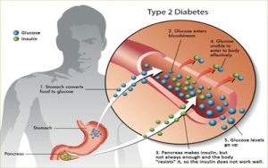Diabetes II Treatment Giostar