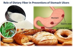 Role of Dietary Fiber in Preventions of Stomach Ulcers