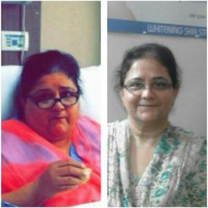 Before After Success Story