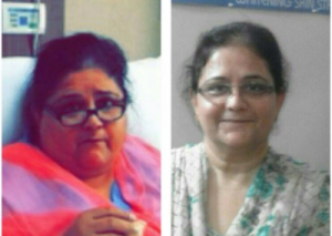 Before After Success Story