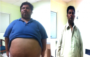 Before After Success Story