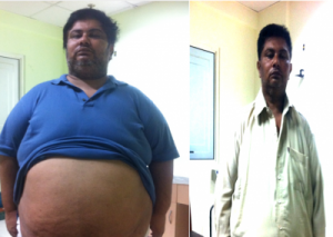 Before After Success Story