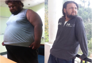 Before After Success Story