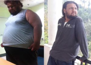 Before After Success Story