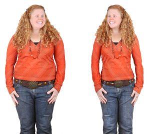 best weight loss surgery