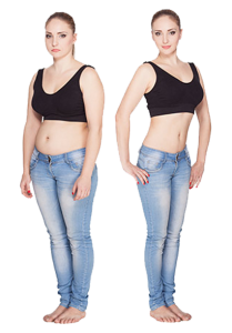 best weight loss surgery