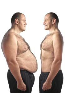 Bariatric surgery Mohali