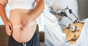 best bariatric surgeon