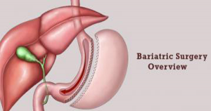 best diabetes treatment