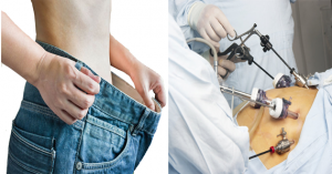 best bariatric surgeon