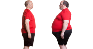 best weight loss surgery