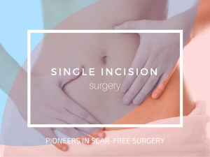 single incision