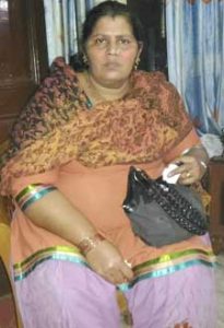 before weight loss surgery