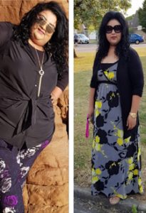 Bariatric surgeon Punjab