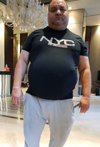 before bariatric surgery