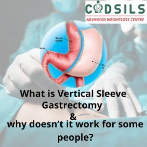VERTICAL SLEEVE gastrectomy