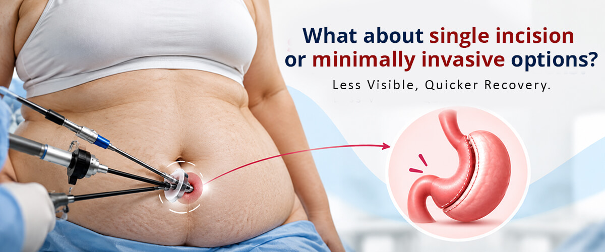 Gastric Sleeve vs Gastric Bypass